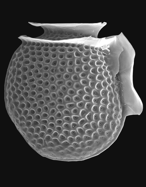 Figs 3.4 a-d Dinophysis meterori, D. operculoides, D. ovum and D. punctata